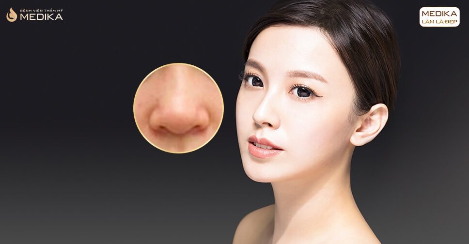 Những phương pháp thu gọn cánh mũi không phẫu thuật nên thử bởi Nangmuicautrucdep.com