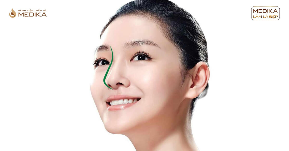 Đối tượng nào có thời gian hồi phục lâu hơn khi nâng mũi bọc sụn ở Nangmuicautrucdep.com?